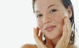 Пятна на лице: стоит ли беспокоиться?