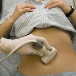 УЗД при вагітності: чому дані бувають помилковими