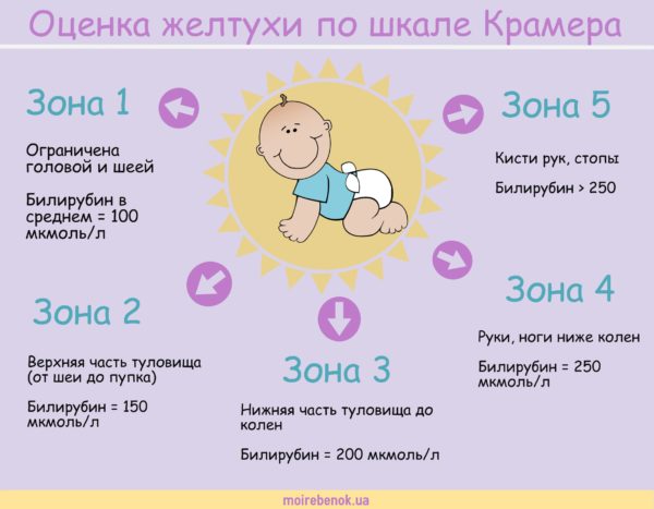 дифференциальная диагностика желтухи - инфографика