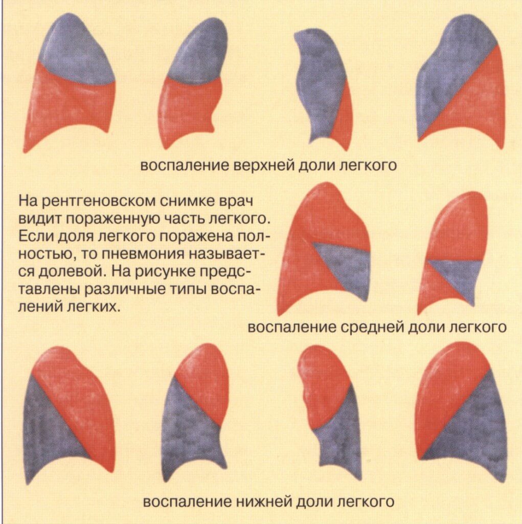Источник: myfamilydoctor.ru