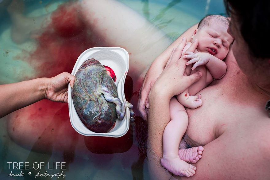 Источник: Birth Photo Competition
