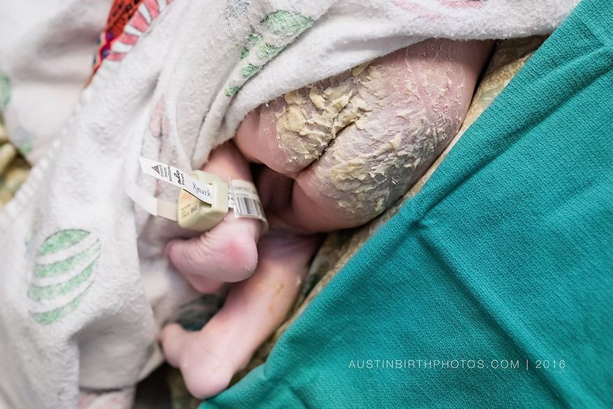 Источник: Birth Photo Competition
