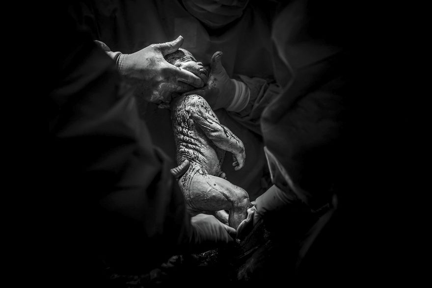 Источник: Birth Photo Competition