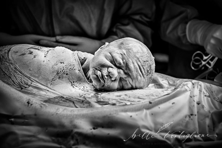 Источник: Birth Photo Competition