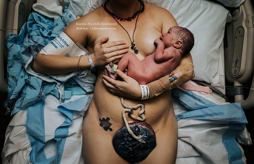 Источник: Birth Photo Competition