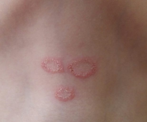 Джерело: instagram @dr.marinakatkovam