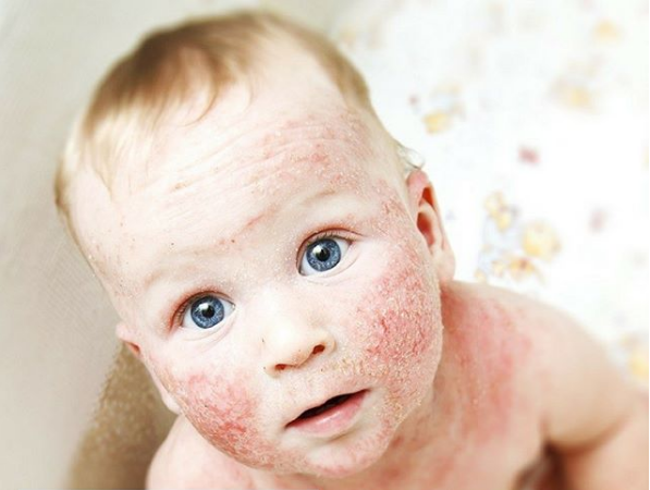 Джерело: instagram @yogurtelspb
