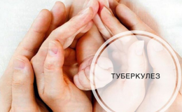 5 міфів про туберкульоз