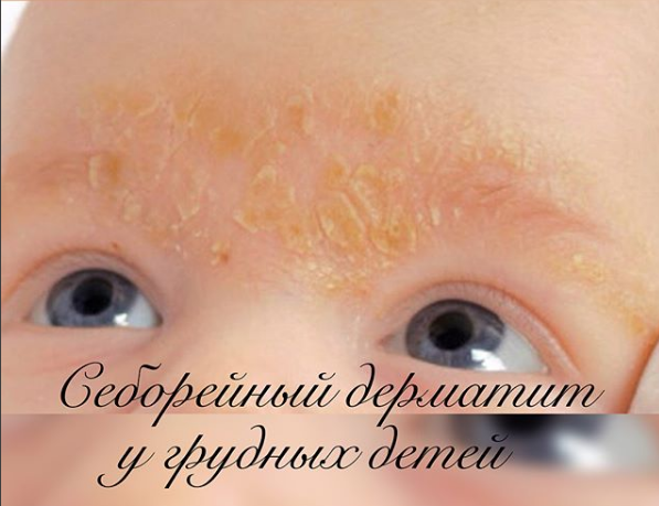 Джерело: instagram @dr_gunina