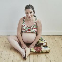 Беременная женщина с ампутированной ногой сделала потрясающую фотосессию