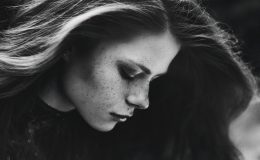 5 небезпечних хвороб, які можна визначити по обличчю