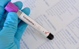Если вы общались с человеком, который заболел коронавирусом – 5 важных шагов