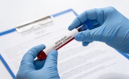 Два продукта, от которых следует отказаться во время коронавируса