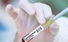 Какие есть тесты на коронавирус и когда проводят тестирование