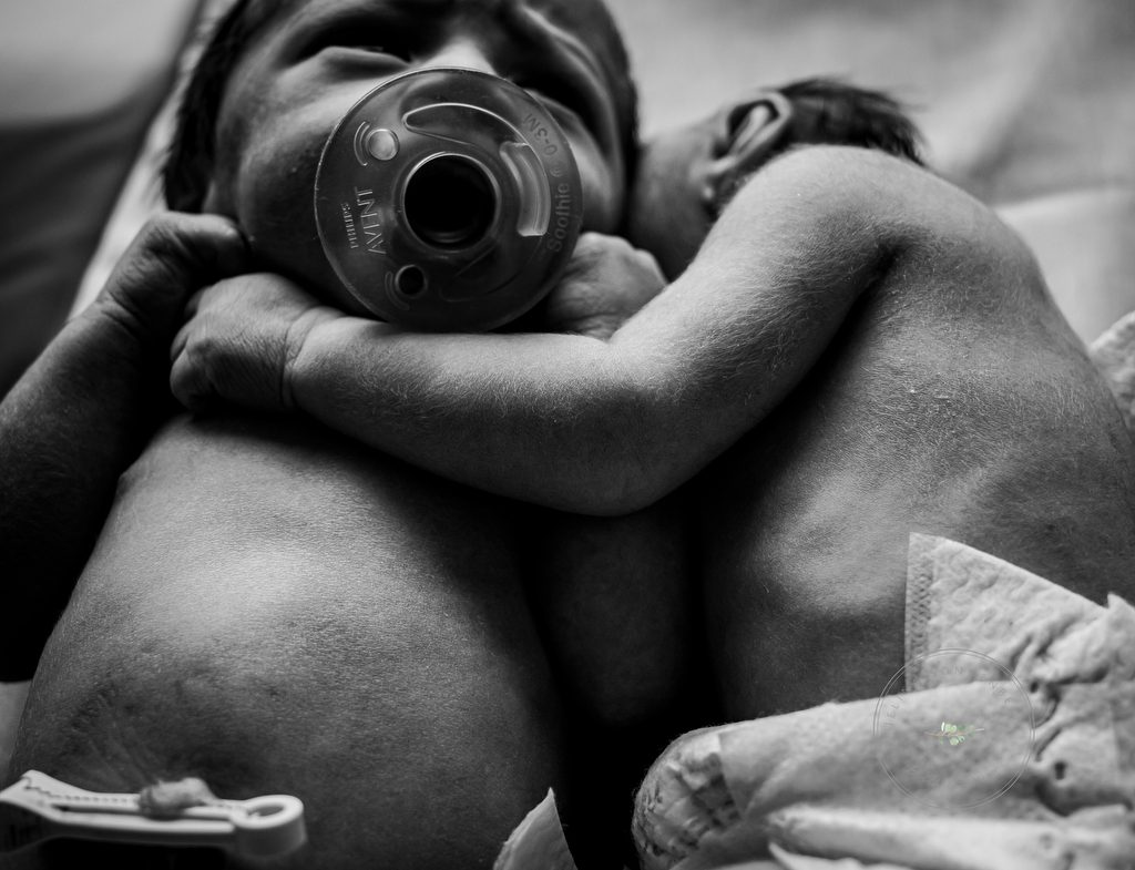 Источник: Birth Photography Image Competition
