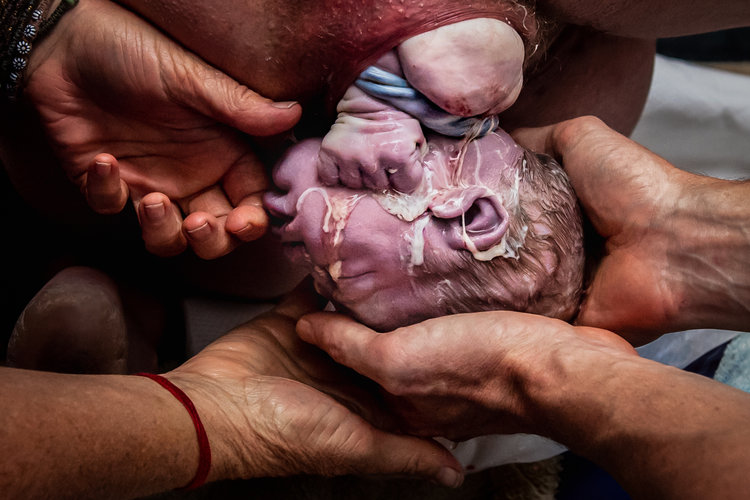 Источник: Birth Photography Image Competition