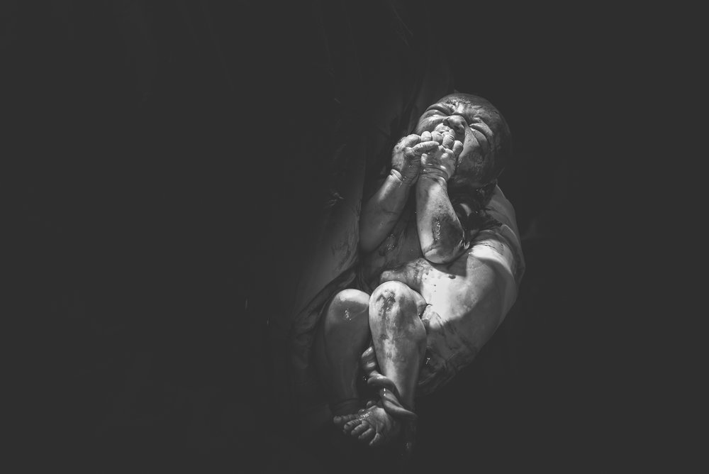 Источник: Birth Photography Image Competition