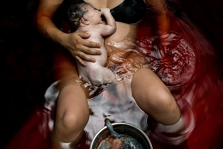 Источник: Birth Photography Image Competition
