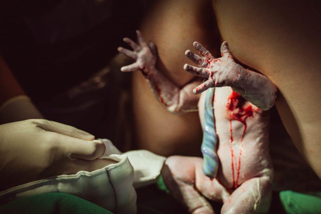 Источник: Birth Photography Image Competition