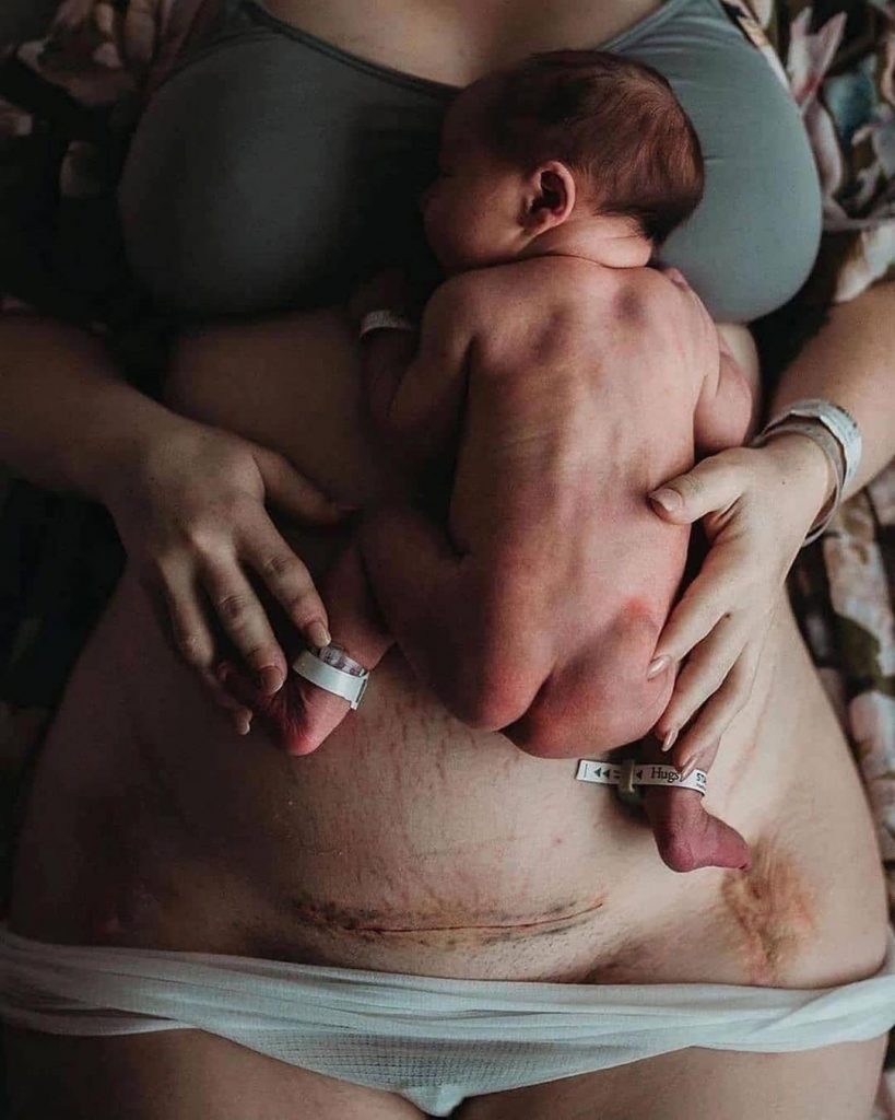 Источник: Instagram@2lifedoula