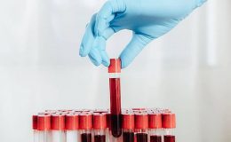 Якщо ви перехворіли на коронавірус, допоможіть вижити іншим: де і як здати кров