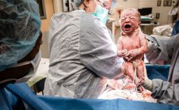 Хто сказав, що це легко? 10 чесних фотографій про пологи шляхом кесаревого розтину