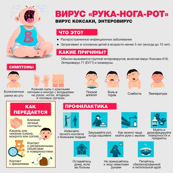 Что такое вирус "Рука-нога-рот"