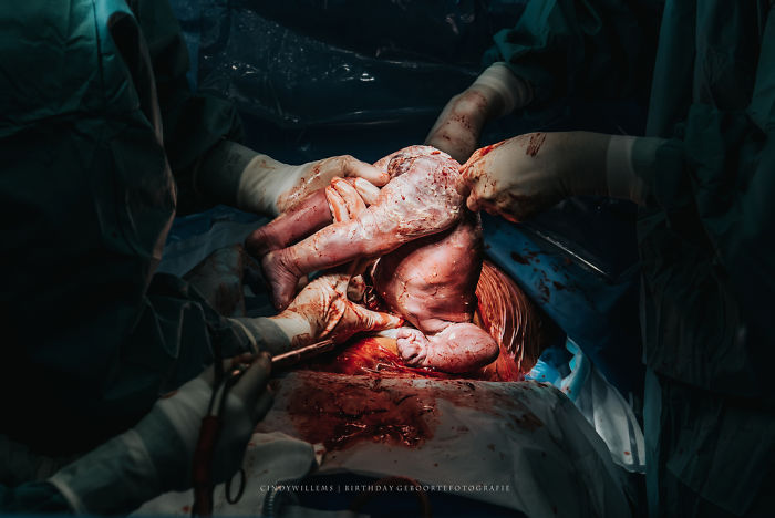 Джерело: birthphotographers.com