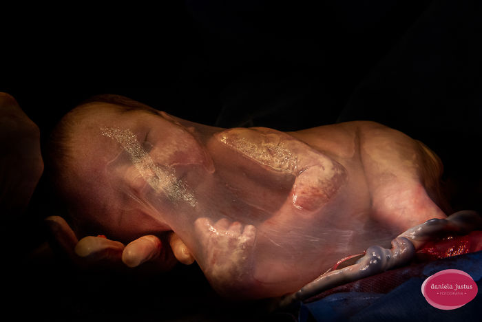 Джерело: birthphotographers.com