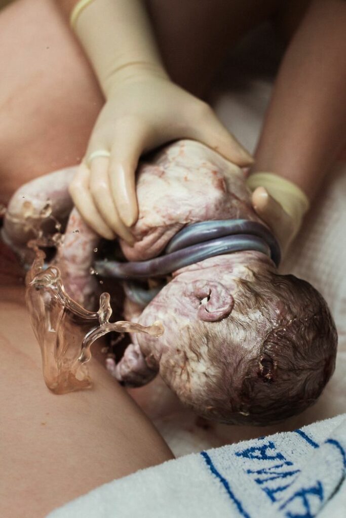 Джерело: birthphotographers.com