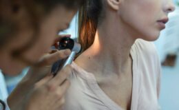 Меланома: 6 признаков опасных родинок