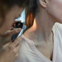 Меланома: 6 признаков опасных родинок