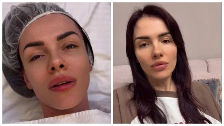 MamaRika після операції