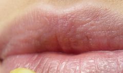 Як захистити губи від сухості взимку: дієві поради