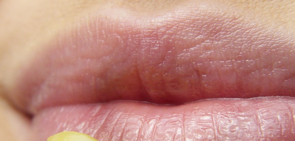 Як захистити губи від сухості взимку: дієві поради