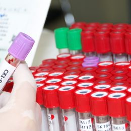 На прийомі у гінеколога: які аналізи потрібно зробити кожній